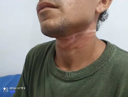 Motociclista cruzó un cable y casi se degüella