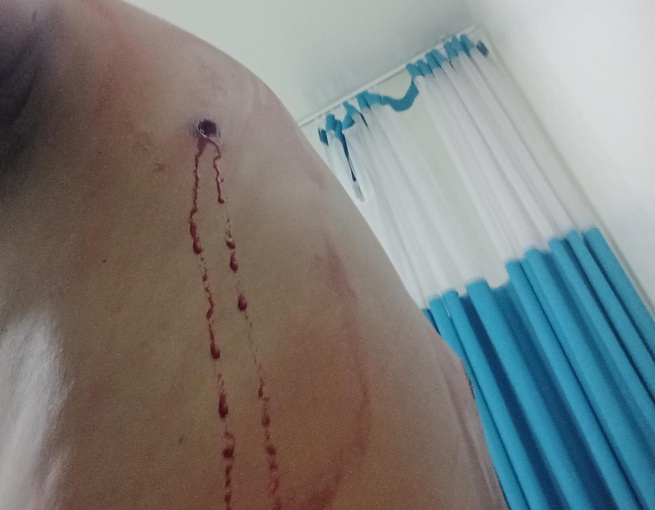 Casi matan a  expolicía