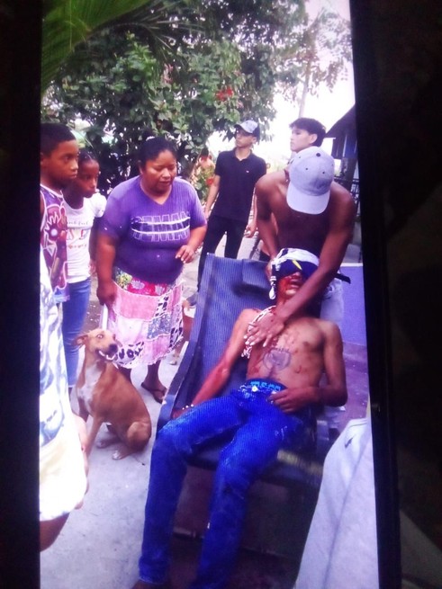 De un tiro en la frente mataron a 'el Bebé'