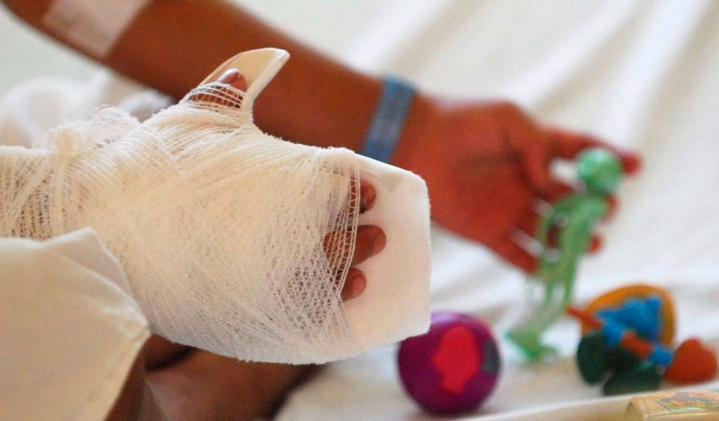 Menor se quemó con pólvora