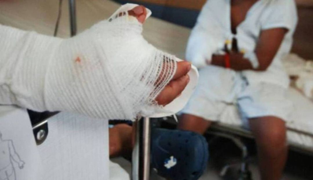 Aumentan quemados con pólvora en Córdoba, dos menores afectados