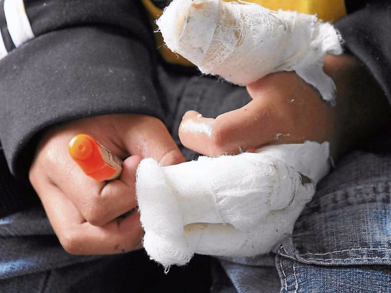Dos muertos y más de 370 lesionados con pólvora en el país