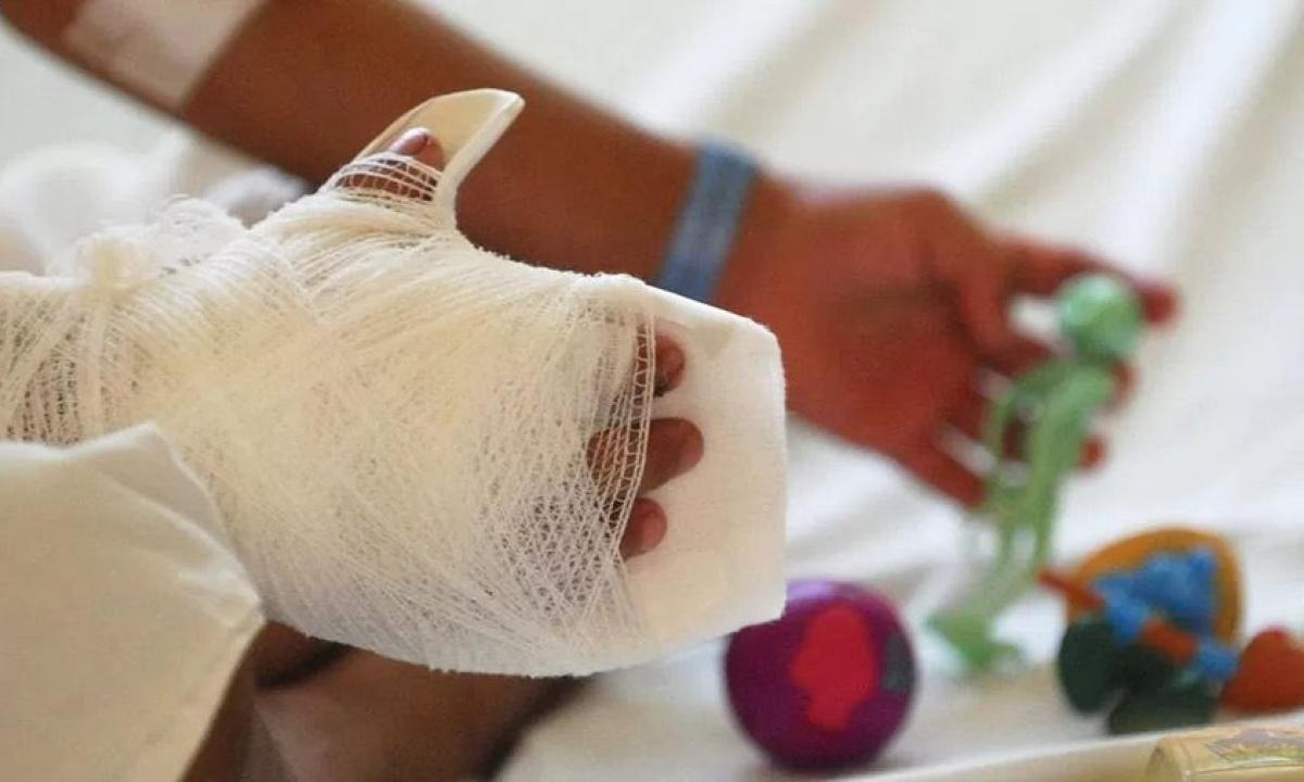 2 muertos y 950 quemados dejó el uso de la pólvora en diciembre