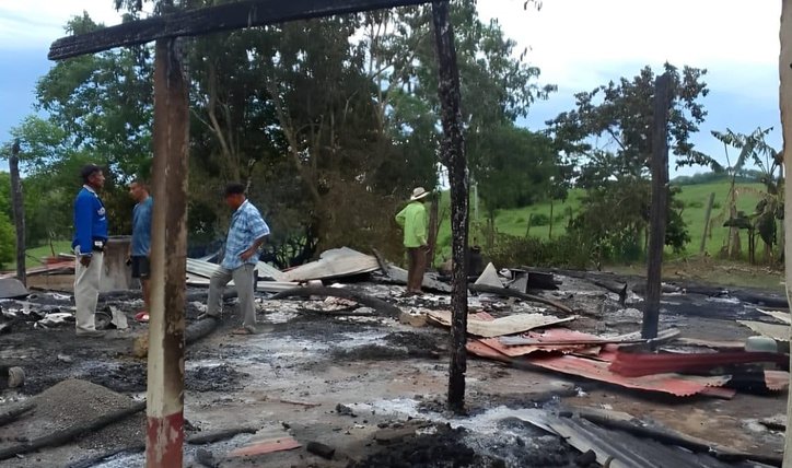 En un incendio sufrió quemaduras graves