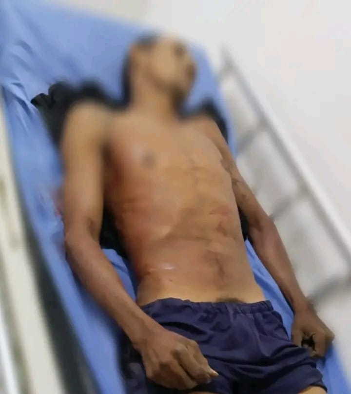 A bala asesinaron a un hombre en Lorica