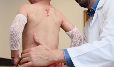 Enfermedades raras en Sucre: 400 casos