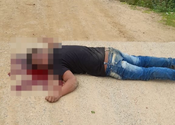 Le dieron bala en la mitad de la vía