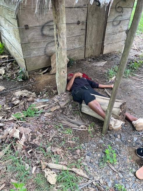 Encuentran el cuerpo de un hombre en zona rural de Tierralta