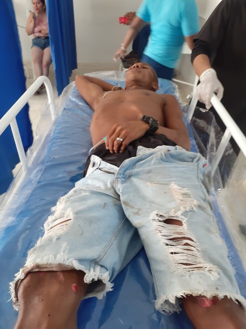 No pasó a mayores, joven se accidentó en Coveñas