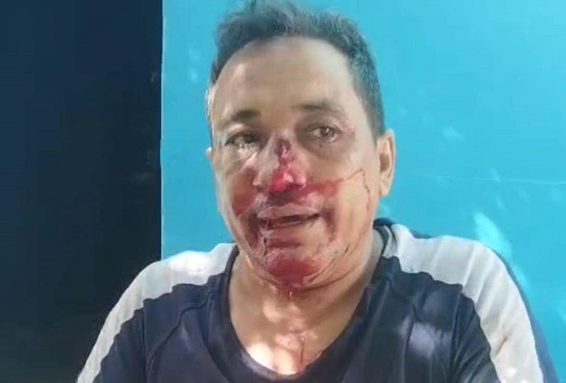 Denuncian brutal ataque a docente en el municipio de San Marcos