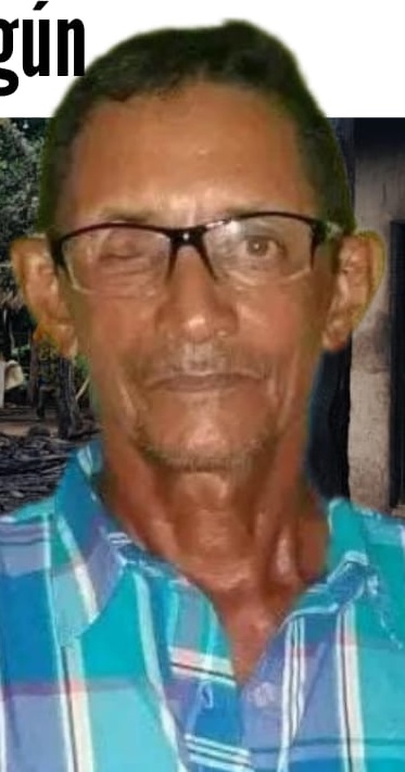 Murió por graves quemaduras