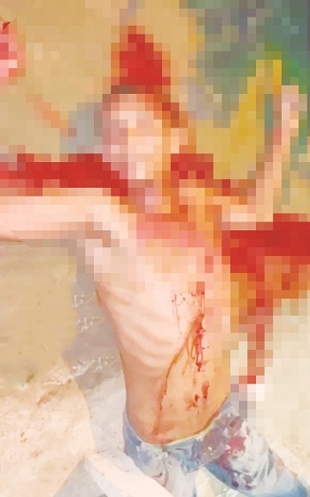 A puñal mataron a Luis en el norte de Sincelejo
