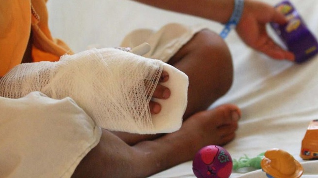 Sucre suma nueve lesionados por pólvora