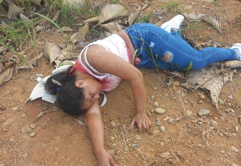 Recibió varias puñaladas de su ex