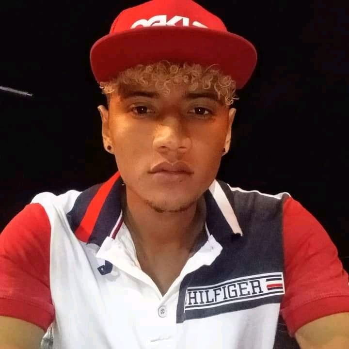Tiene el 80% de su cuerpo quemado