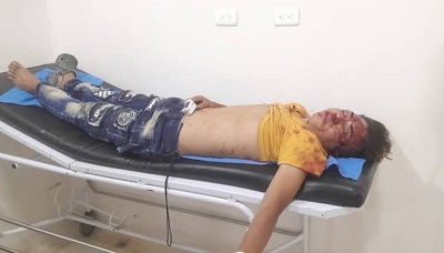 Regresaba de visitar a su novia y se estrelló solito en su moto