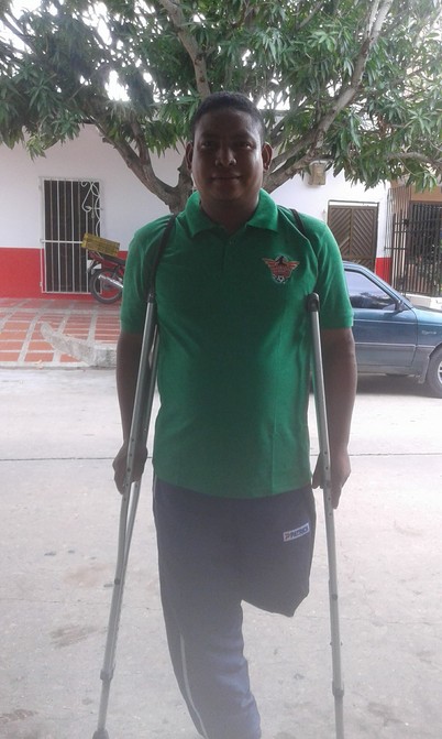 Accidente vial marcó un antes y un después: anhela una prótesis