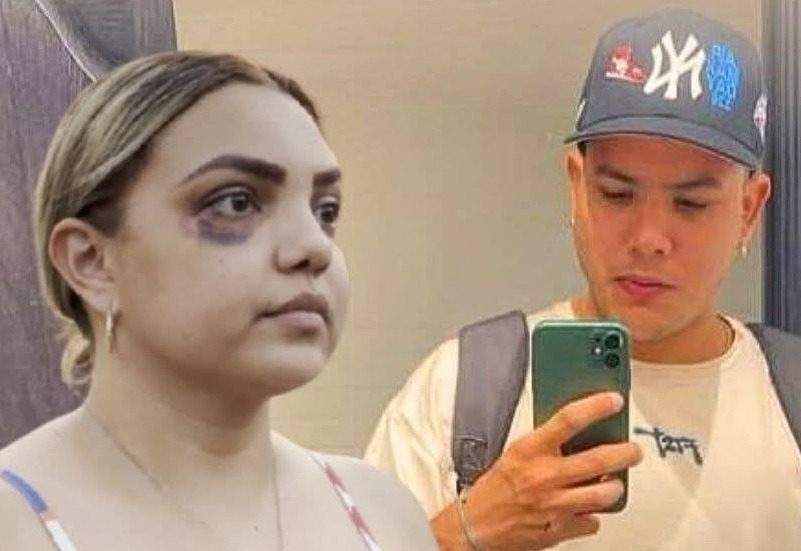 El martes se define la suerte de Joel