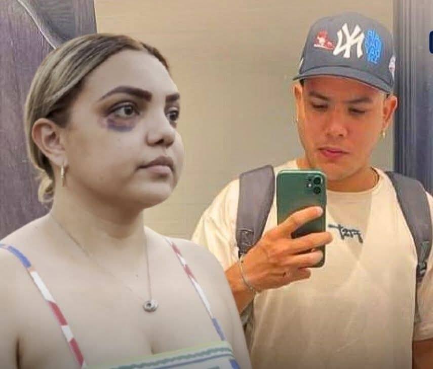 Joel a la casa, pero con brazalete