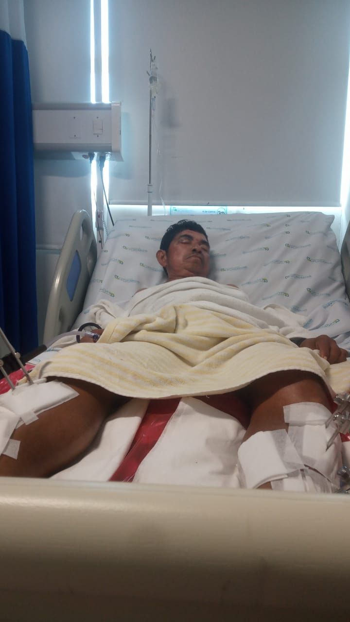 Le fracturaron las dos piernas