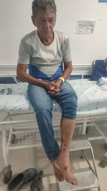Motociclista lo habría  atropellado, está fracturado 