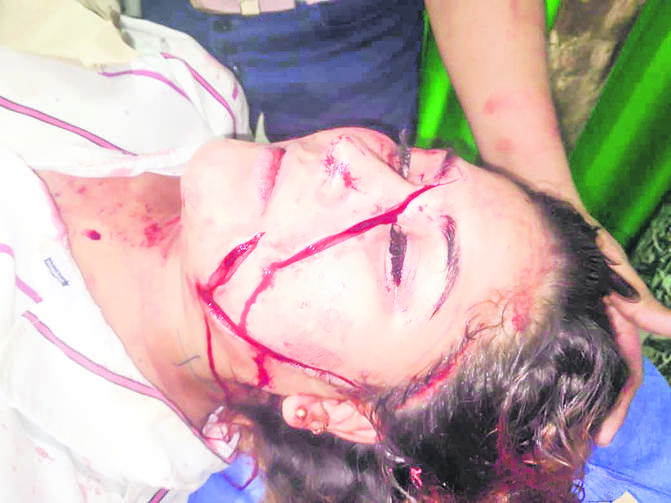 Ataque cruel con pico de botella a una mujer