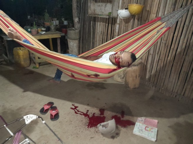 Sicarios le llegaron a su casa a matarlo