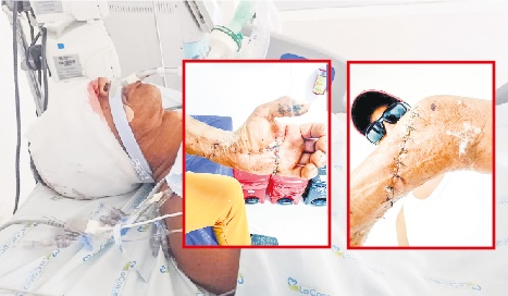 Perdió el ojo y movilidad en el brazo izquierdo