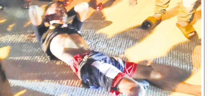 Por un imprudente casi queda sin una pierna