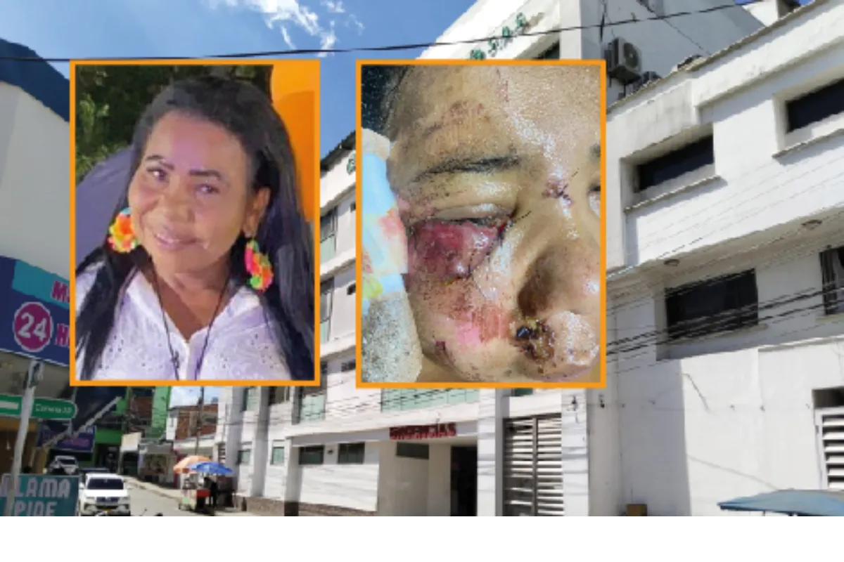 Tiene fractura de pómulo, desvío en el tabique y comprometido un nervio del ojo