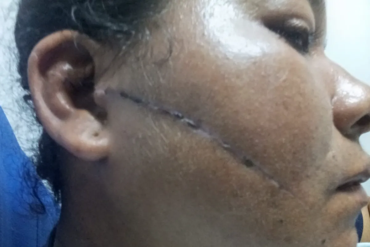 Primero la cacheteó, ahora la macheteó