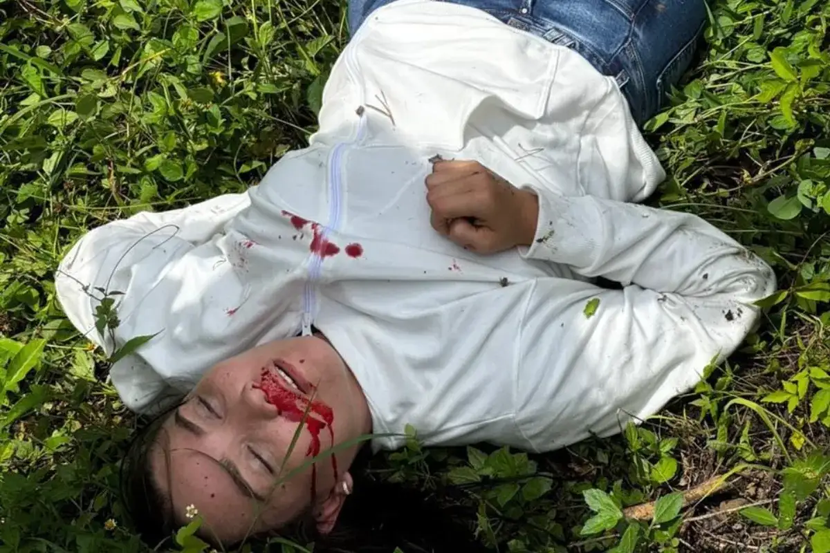 Se le explotó la llanta de la moto