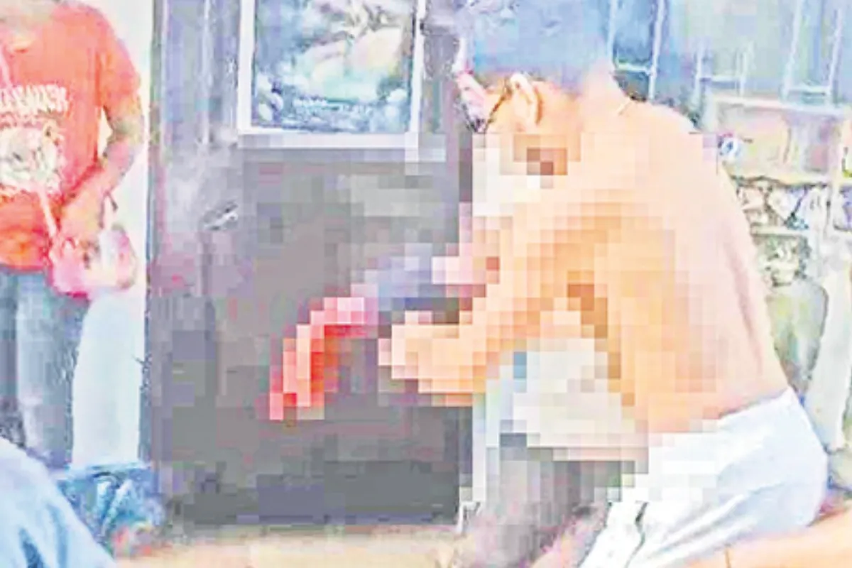 Casi le arrancan la mano de un machetazo