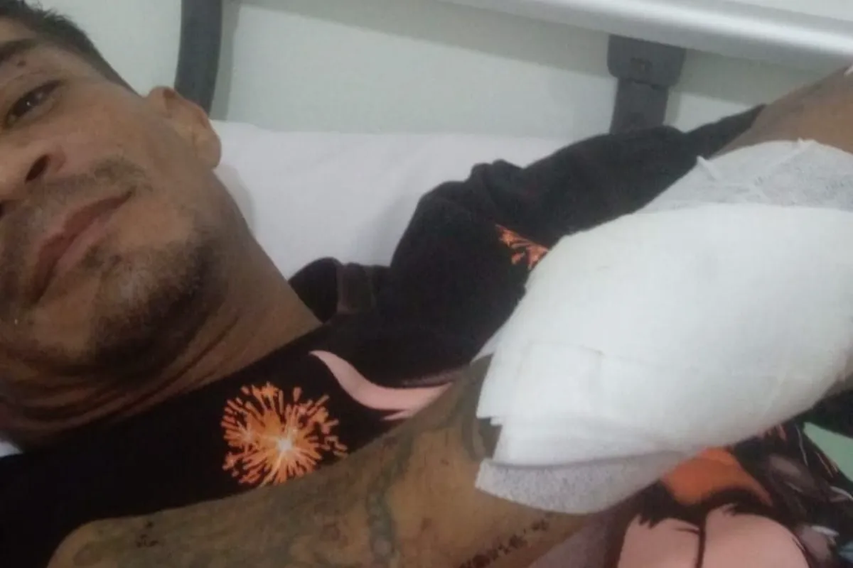 Le dieron un machetazo