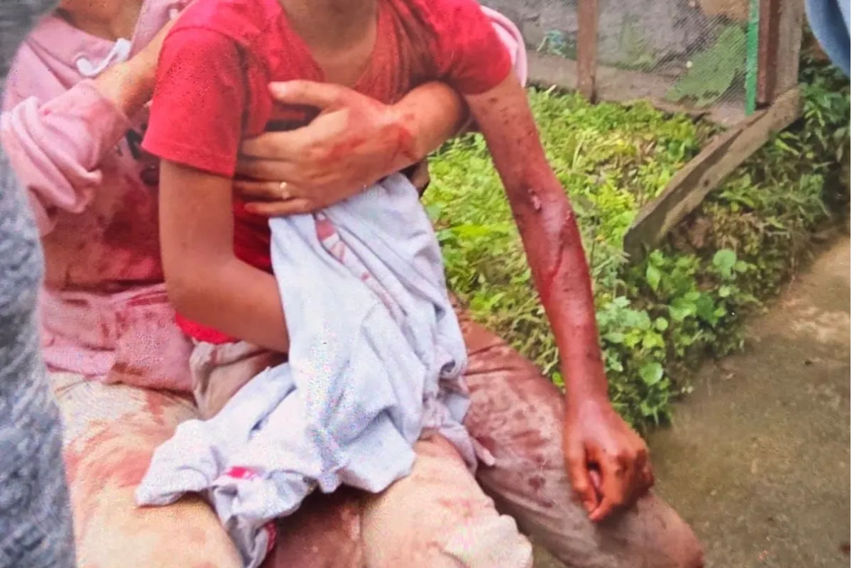 Dos niños de 8 y 6 años resultaron heridos tras ataque de las Farc