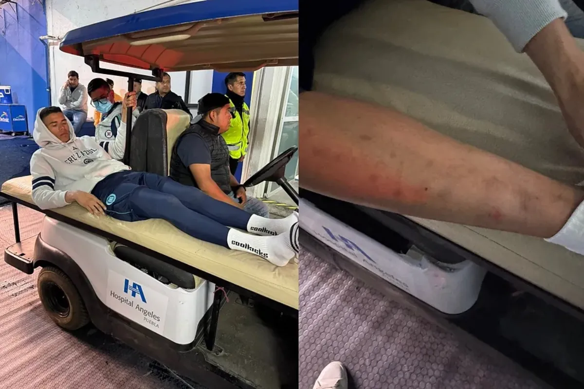 Terrible imagen de la pierna de Kevin Mier, mala noticia para Cruz Azul y la Selección Colombia