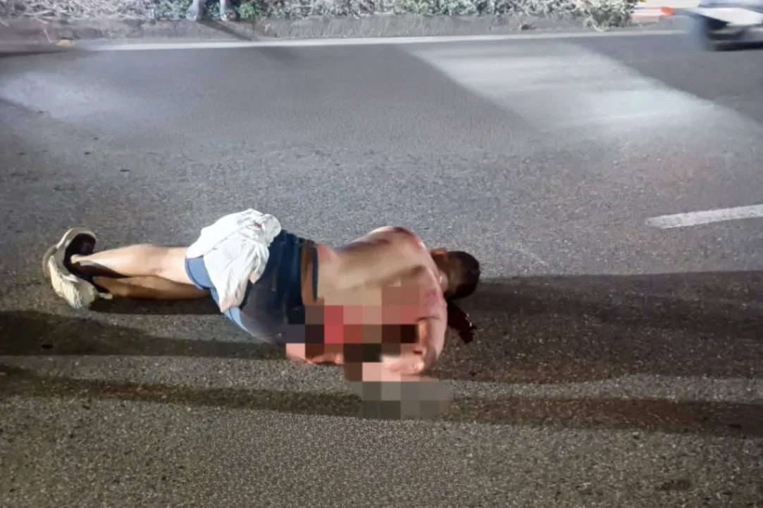 Se cayó de la moto, está grave