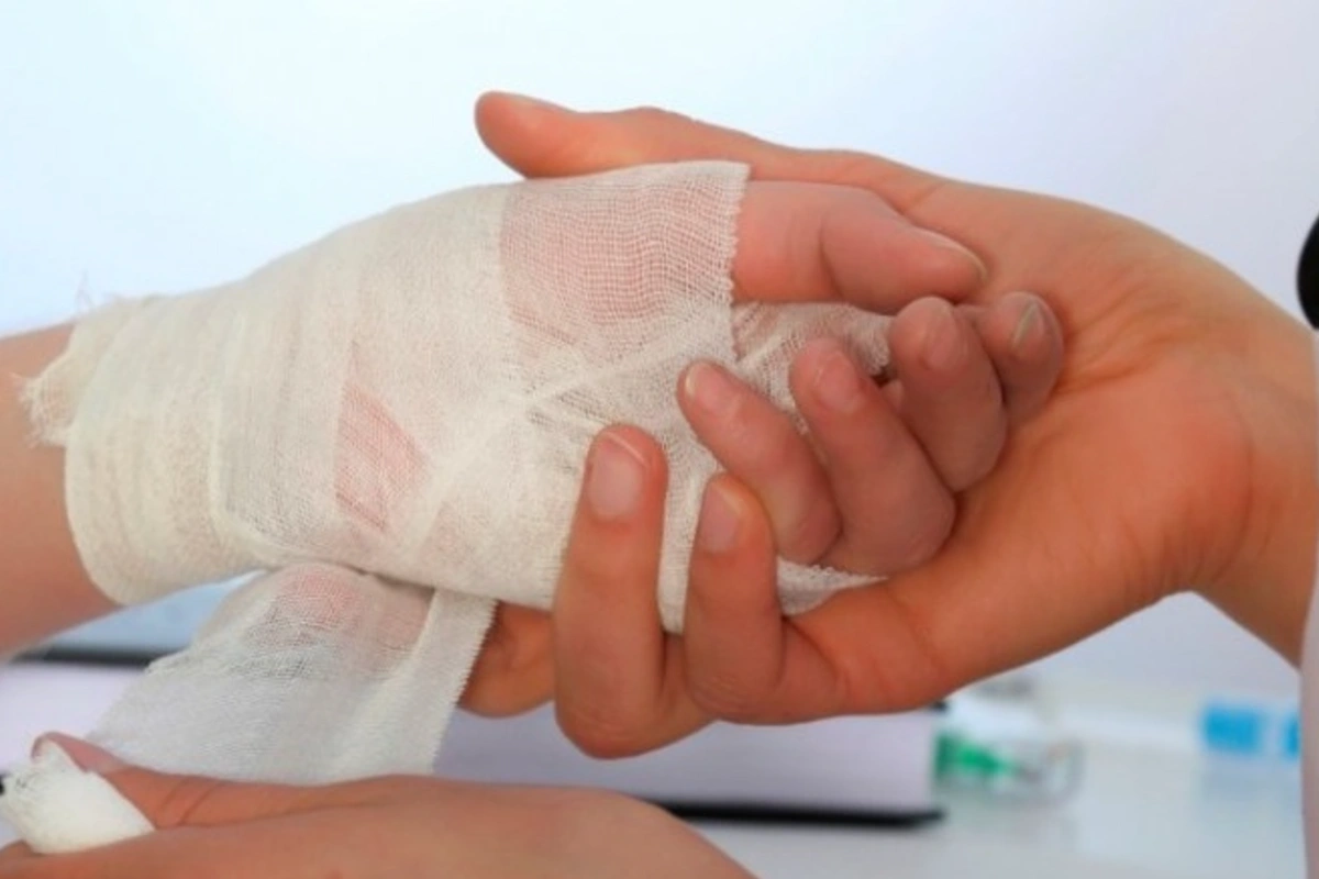 102 lesionados por pólvora en inicio de diciembre en Colombia