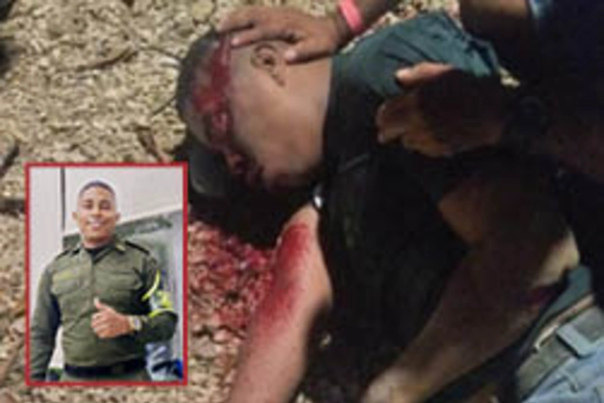 Policía se debate entre la vida y la muerte, tras choque en moto