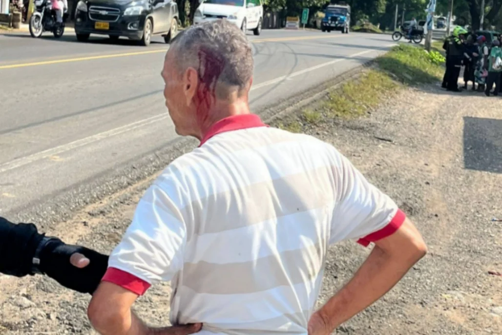 Le dieron con un machete en la cabeza