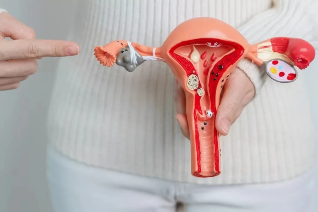 Cáncer de cuello uterino: cómo prevenir una enfermedad silenciosa