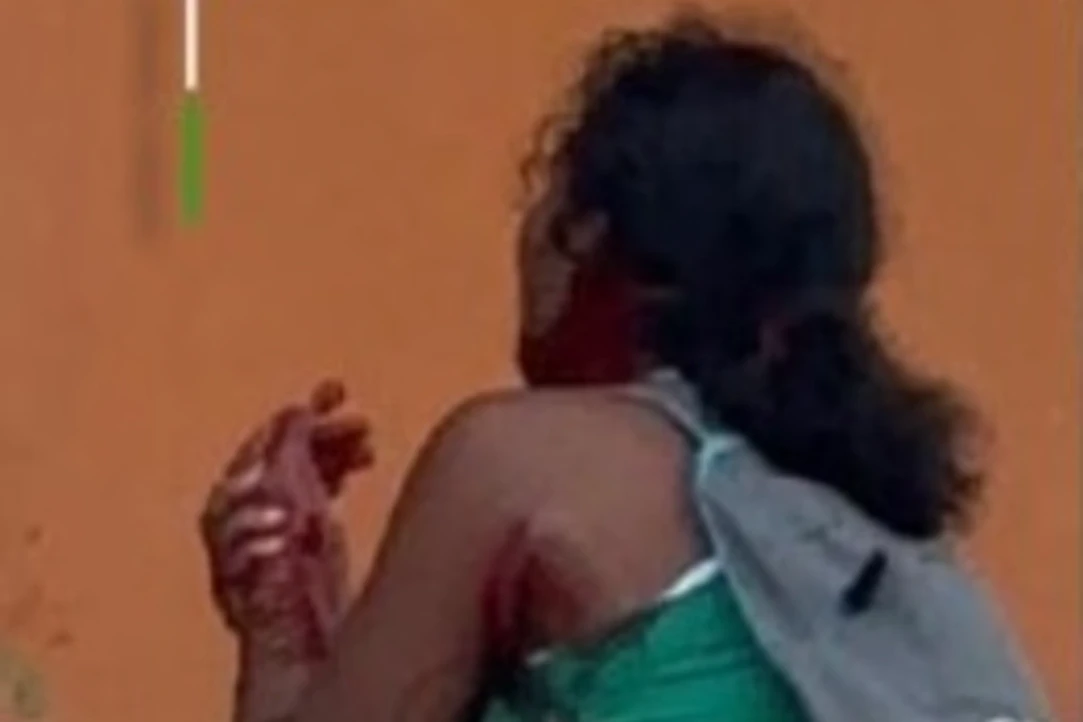 Riña deja dos mujeres heridas