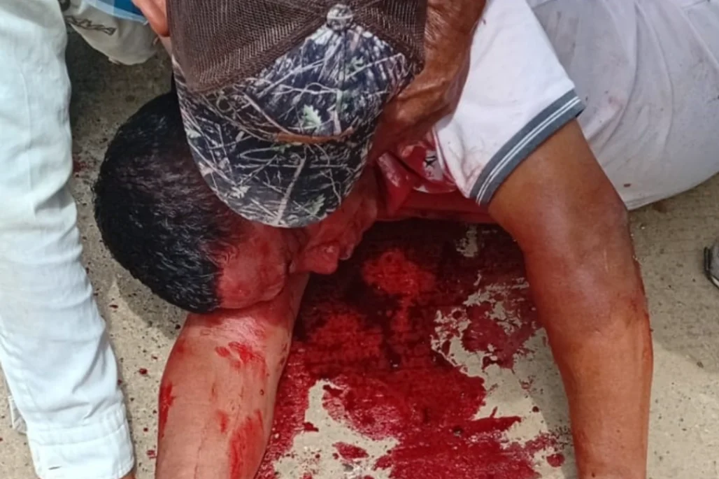 No resistió las heridas