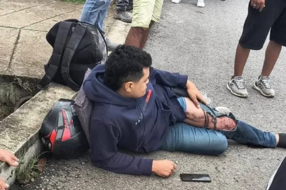 Motociclista resultó herido tras chocar con tractomula