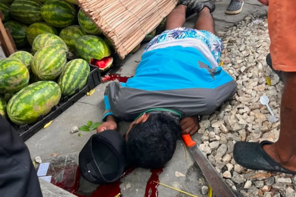 Mataron a 'el Hongo' en puesto de patillas